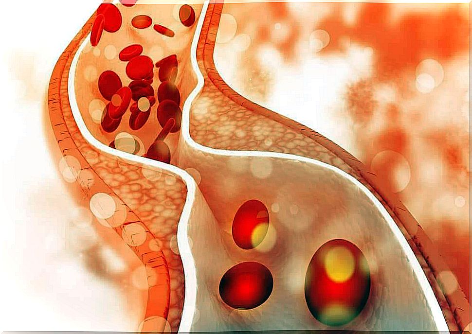 Junk food increases cholesterol