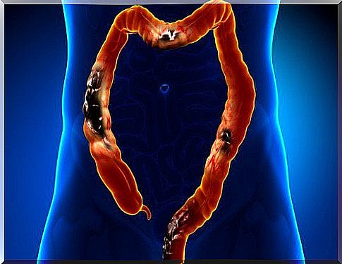 Pain in the digestive tract