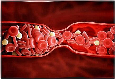 Cholesterol in the blood vessels