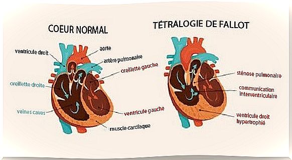 Cardiac patterns