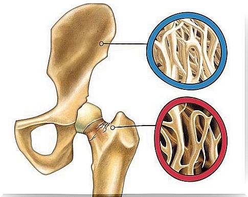 What is the link between bone density and menopause