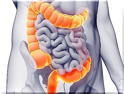 What are the symptoms of colon cancer